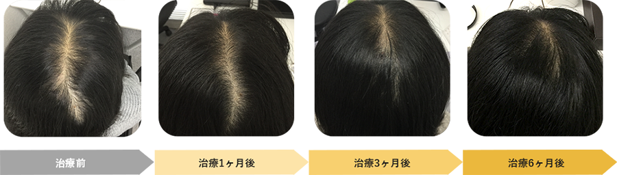 治療症例2 イメージ写真