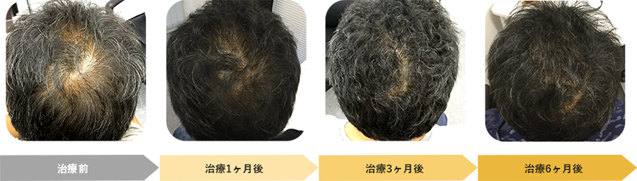 治療症例1 イメージ写真