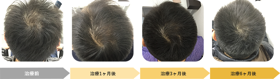 治療症例2 イメージ写真