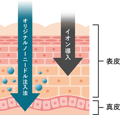 イオン導入の20倍の浸透力