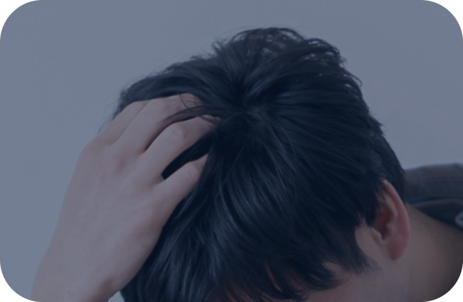 男性の薄毛(AGA)の原因・タイプ